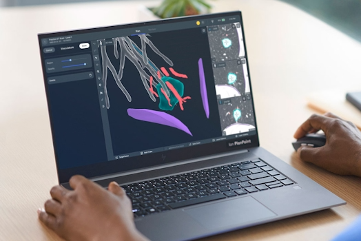 Intuitive Surgical — Advanced Product Design